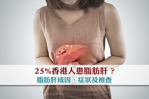 25%香港人患脂肪肝- 脂肪肝成因-症狀及檢查-慎防變肝硬化硬癌